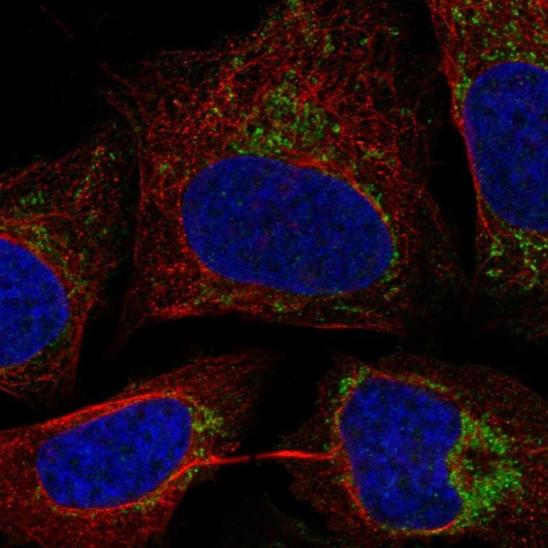 C17orf80 Antibody Immunocytochemistry/Immunofluorescence: C17orf80 Antibody [NBP3-25310]
