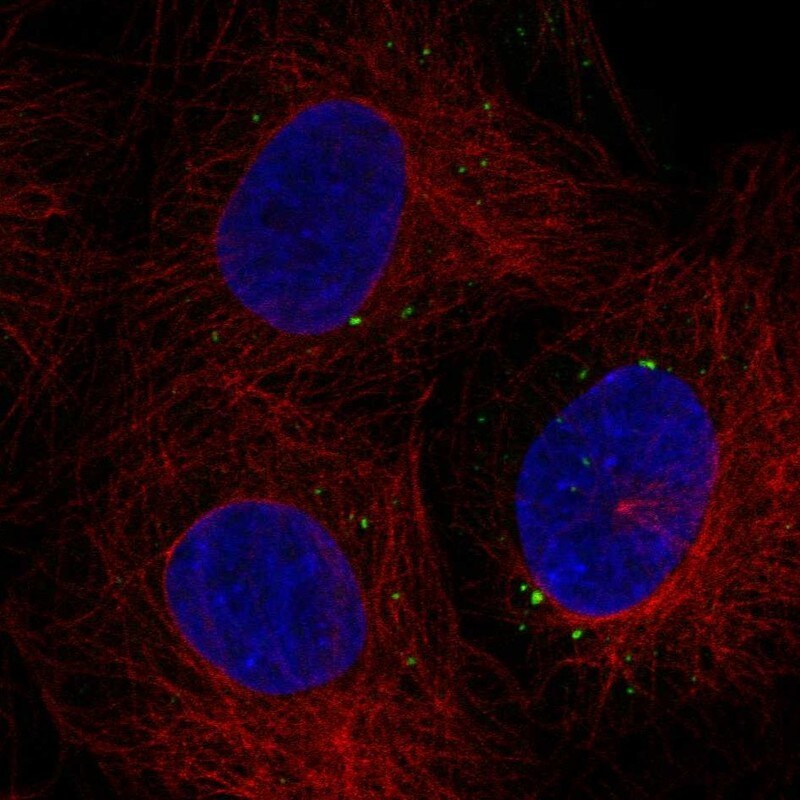 C1orf105 Antibody Immunocytochemistry/Immunofluorescence: C1orf105 Antibody [NBP3-25312]