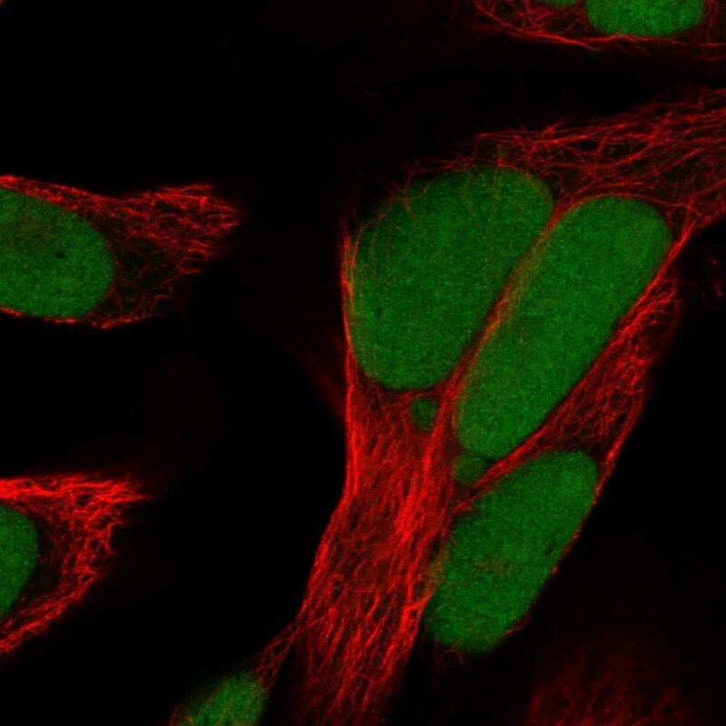 HMGB1/HMG-1 Antibody Immunocytochemistry/Immunofluorescence: HMGB1/HMG-1 Antibody [NBP3-25326]