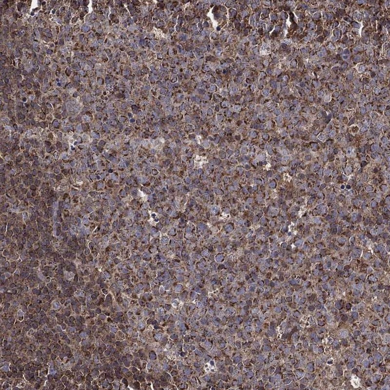 RIG-I Antibody Immunohistochemistry-Paraffin: RIG-I Antibody [NBP3-25330]