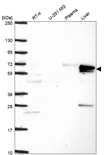 Carboxylesterase 2/CES2 Antibody Western Blot: Carboxylesterase 2/CES2 Antibody [NBP3-25334]