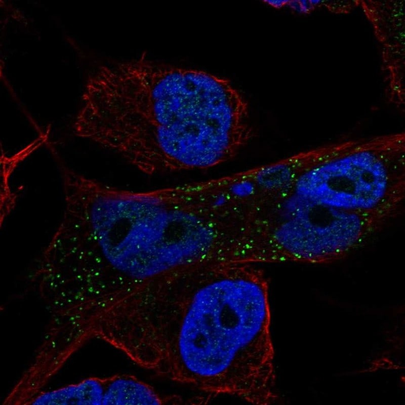 CARD12 Antibody Immunocytochemistry/Immunofluorescence: CARD12 Antibody [NBP3-25336]