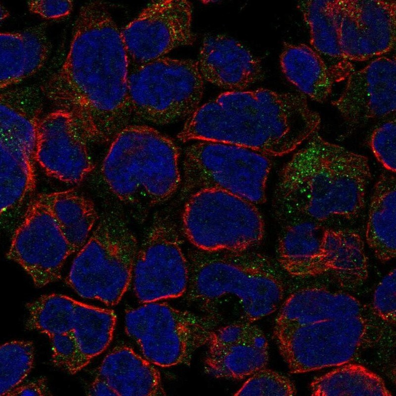 CASC1 Antibody Immunocytochemistry/Immunofluorescence: CASC1 Antibody [NBP3-25338]