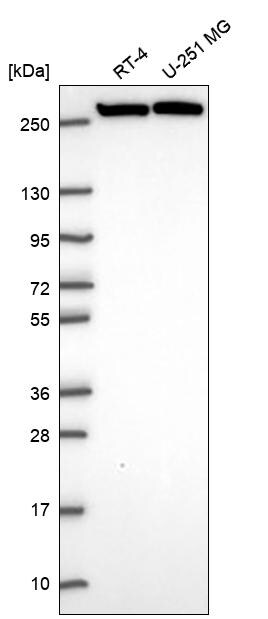 CAD Antibody Western Blot: CAD Antibody [NBP3-25340]