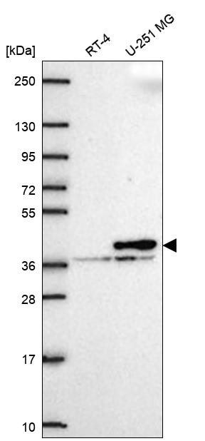 Calponin 2 Antibody Western Blot: Calponin 2 Antibody [NBP3-25343]