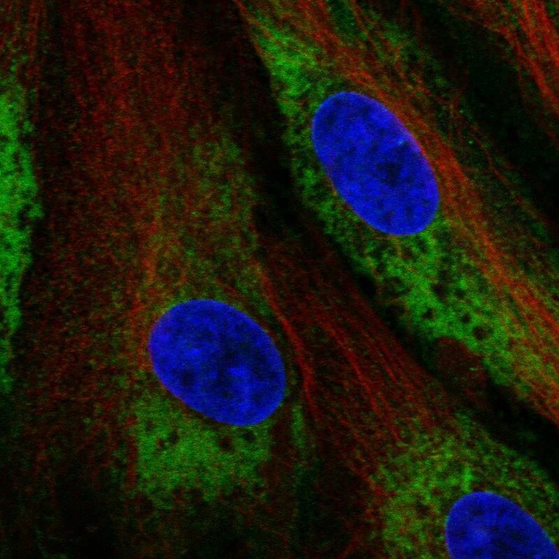 Calumenin Antibody Immunocytochemistry/Immunofluorescence: Calumenin Antibody [NBP3-25348]
