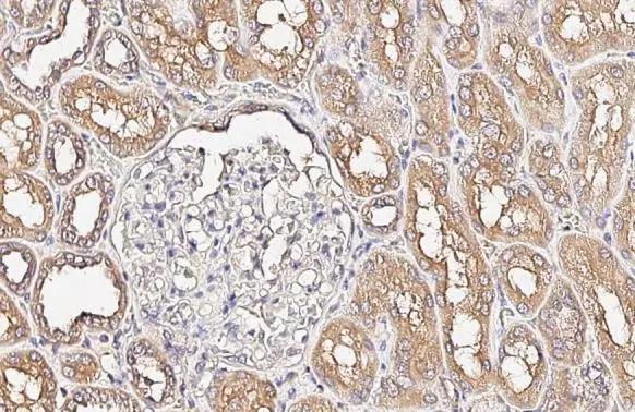 Alkaline Phosphatase, Tissue Non-Specific Antibody (HL2003) - Azide and BSA Free