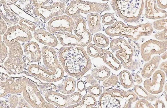 Alkaline Phosphatase, Tissue Non-Specific Antibody (HL2003) - Azide and BSA Free
