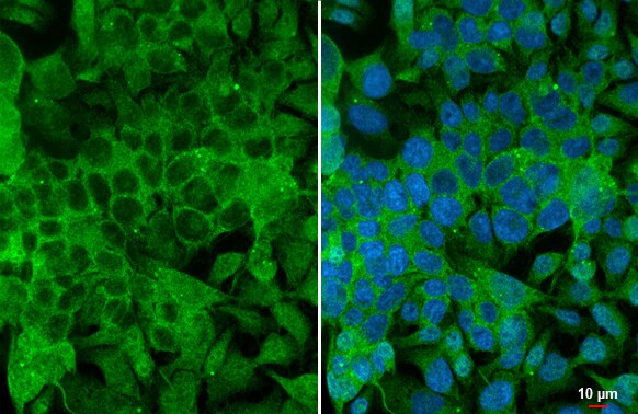 Angiogenin Antibody (HL2215) - Azide and BSA Free