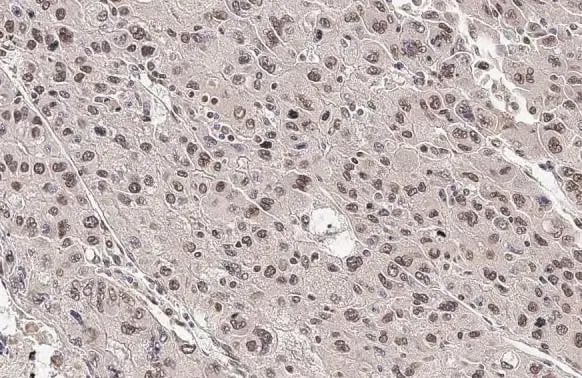 ARID1A Antibody (HL2304) - Azide and BSA Free