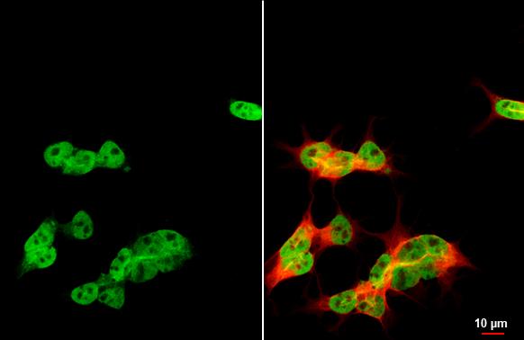 ARID1A Antibody (HL2304) - Azide and BSA Free