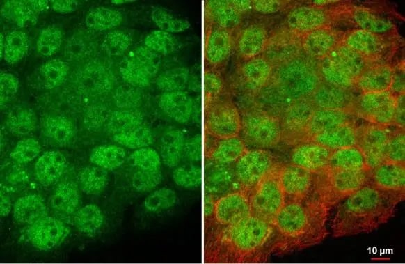 Artemis Antibody (HL1227) - Azide and BSA Free