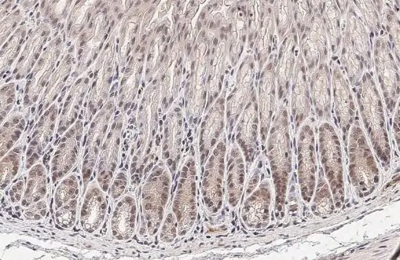 Ataxin-3 Antibody (HL1909) - Azide and BSA Free