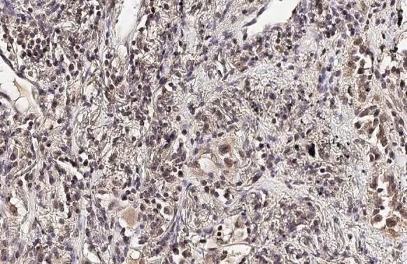 Ataxin-3 Antibody (HL1909) - Azide and BSA Free