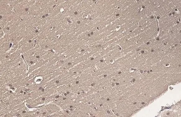 Ataxin-3 Antibody (HL1909) - Azide and BSA Free