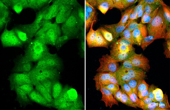 Ataxin-3 Antibody (HL1909) - Azide and BSA Free