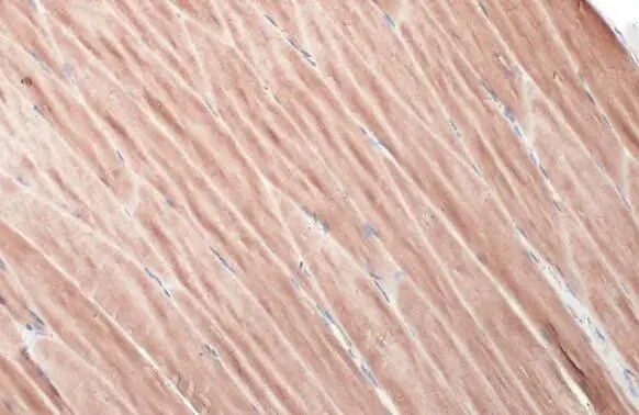 ATP6V1H Antibody (HL1316) - Azide and BSA Free