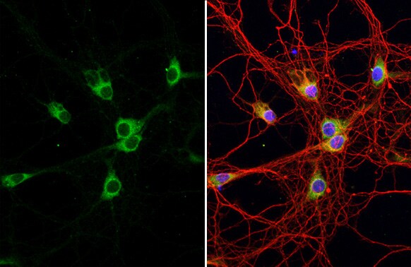 Ataxin-2 Antibody (HL1902) - Azide and BSA Free