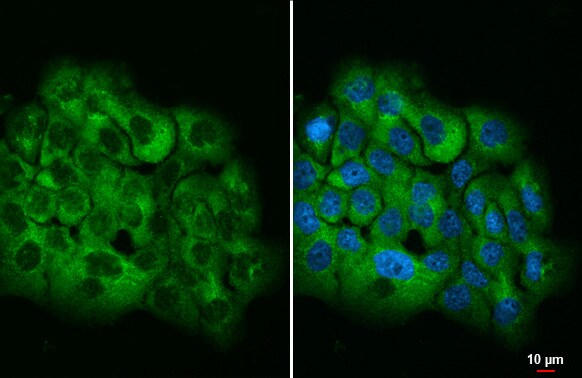 Ataxin-2 Antibody (HL1902) - Azide and BSA Free
