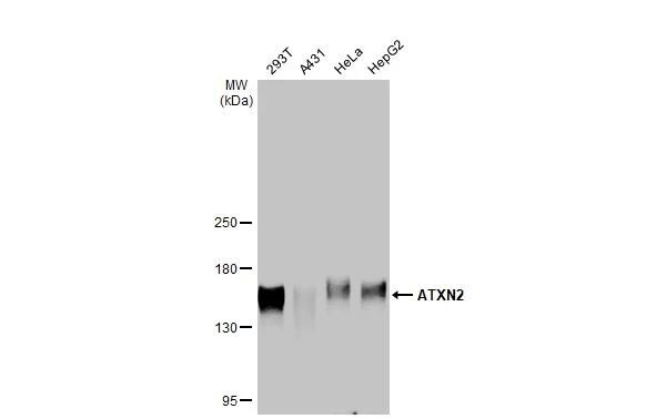 Ataxin-2 Antibody (HL1902) - Azide and BSA Free