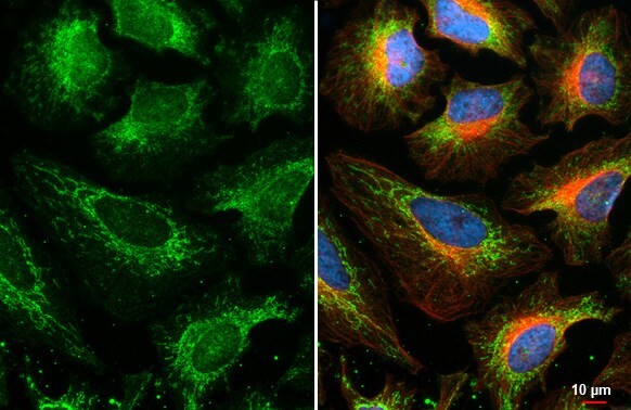 BCKDHA Antibody (HL2405) - Azide and BSA Free
