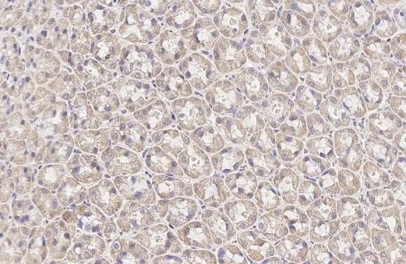 BCKDHA Antibody (HL2434) - Azide and BSA Free