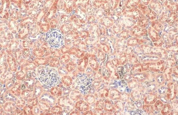 BNIP3L Antibody (HL1203) - Azide and BSA Free