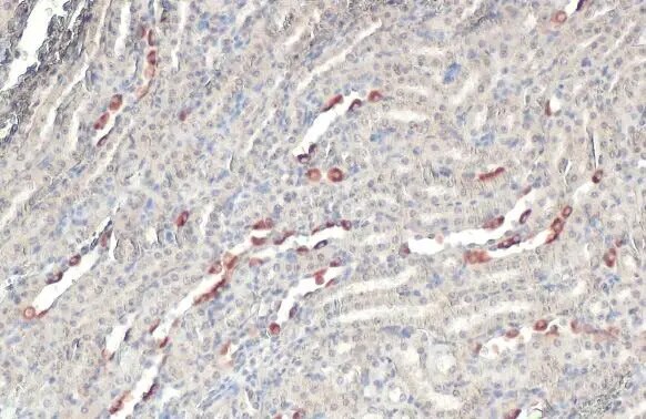 BRD9 Antibody (HL1282) - Azide and BSA Free