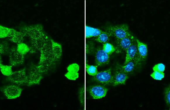 Serpin G1/C1 Inhibitor Antibody (HL1196) - Azide and BSA Free