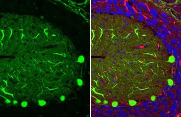 Calbindin D-28K Antibody (HL2379) - Azide and BSA Free