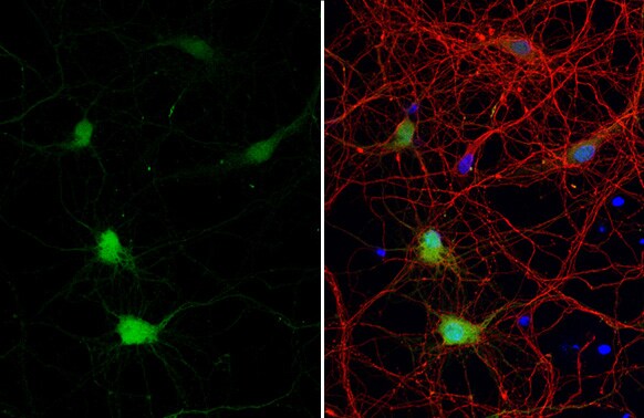 Calbindin D-28K Antibody (HL2379) - Azide and BSA Free