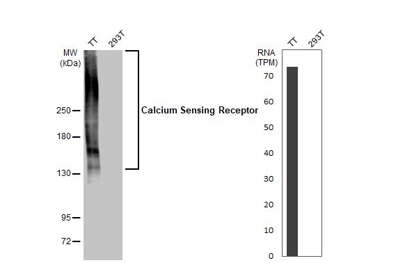 Calcium-sensing R/CaSR Antibody (HL2357) - Azide and BSA Free