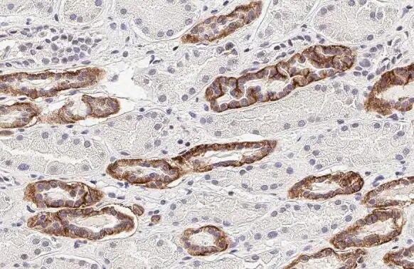 Calcium-sensing R/CaSR Antibody (HL2357) - Azide and BSA Free