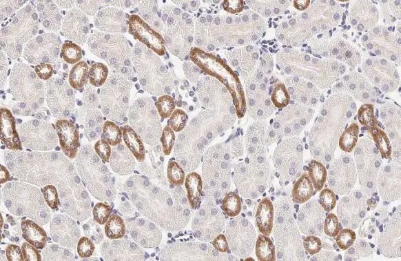 Calcium-sensing R/CaSR Antibody (HL2357) - Azide and BSA Free