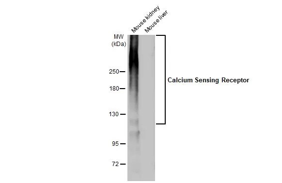 Calcium-sensing R/CaSR Antibody (HL2357) - Azide and BSA Free
