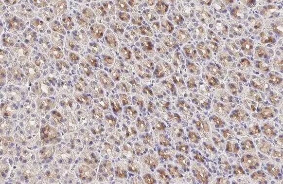 Calpain 5 Antibody (HL2432) - Azide and BSA Free