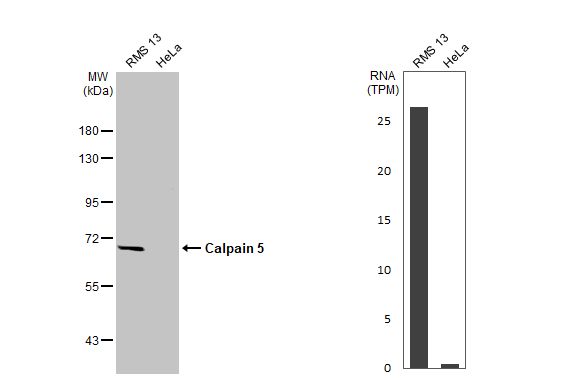 Calpain 5 Antibody (HL2432) - Azide and BSA Free