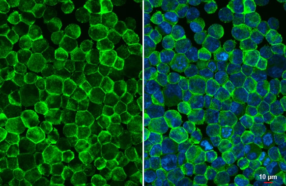 Fc gamma RIIB/CD32b Antibody (HL1948) - Azide and BSA Free