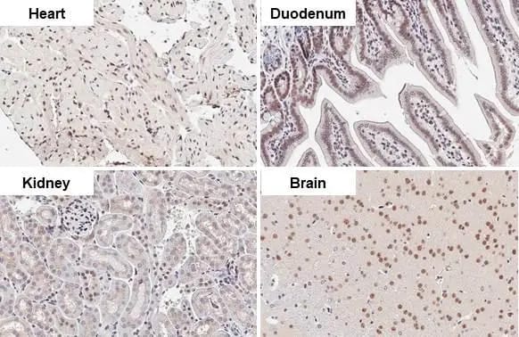 CHD2 Antibody (HL2066) - Azide and BSA Free