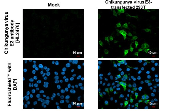 Chikungunya Virus E3 Antibody (HL2476) - Azide and BSA Free