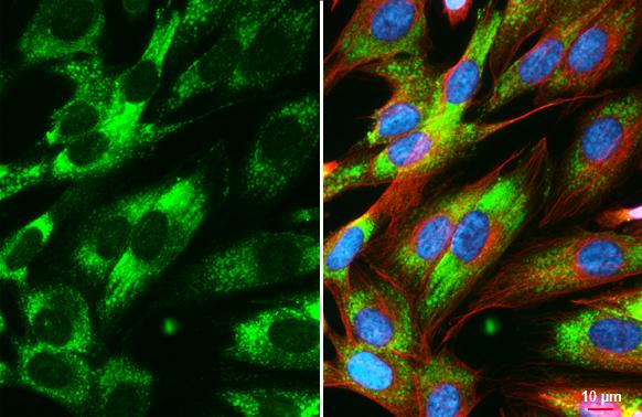 Collagen IV alpha 1 Antibody (HL1351) - Azide and BSA Free