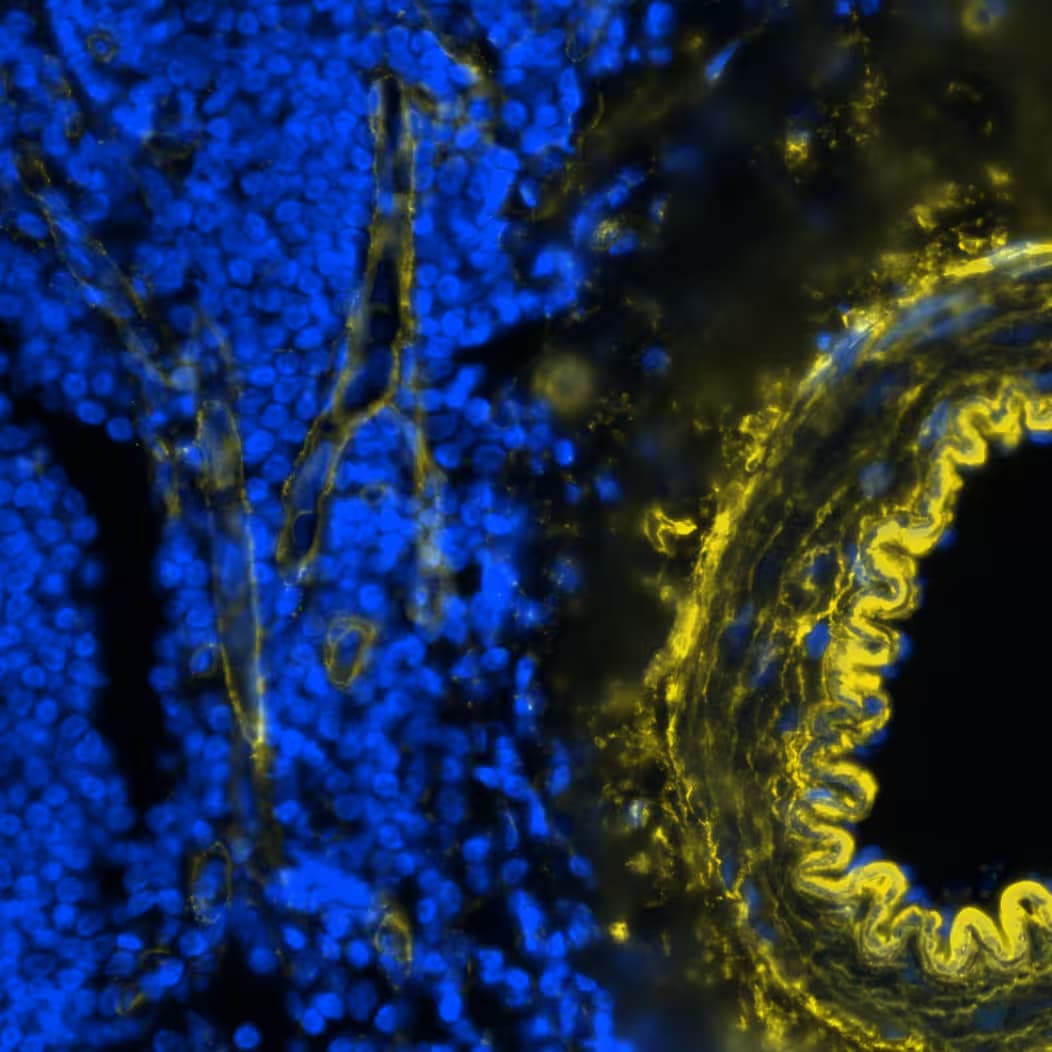 Collagen IV alpha 1 Antibody (HL1351) - Azide and BSA Free