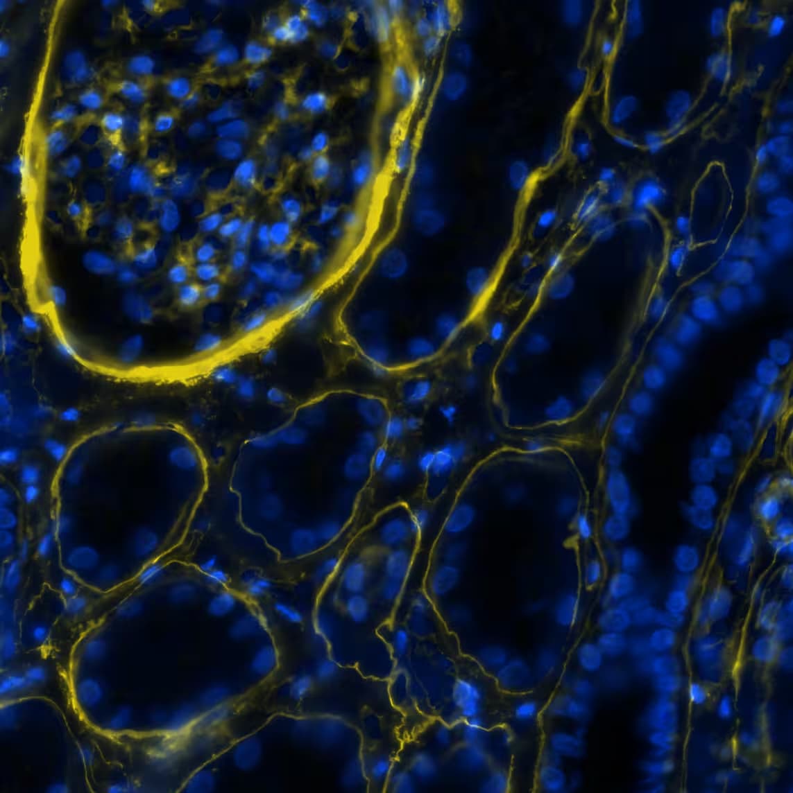 Collagen IV alpha 1 Antibody (HL1351) - Azide and BSA Free