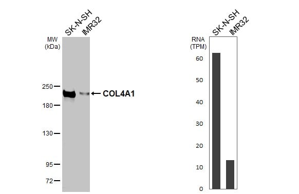 Collagen IV alpha 1 Antibody (HL1351) - Azide and BSA Free