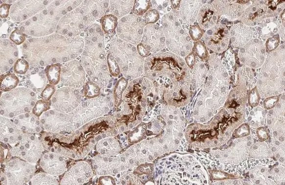 Collagen I/II/III Antibody (HL2048 + HL1907) - Azide and BSA Free