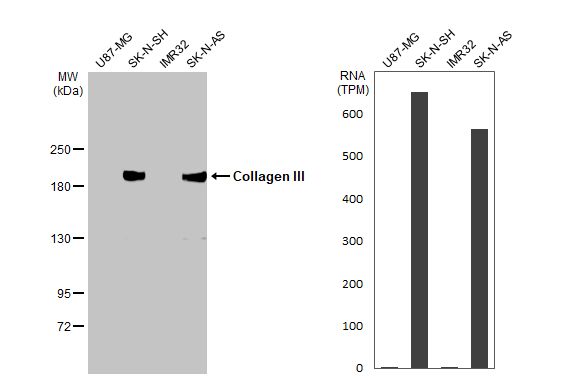 Collagen III alpha 1/COL3A1 Antibody (HL1906) - Azide and BSA Free