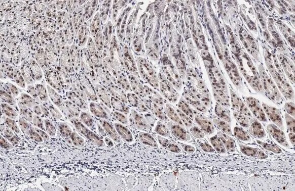HMGA2 Antibody (HL1936) - Azide and BSA Free