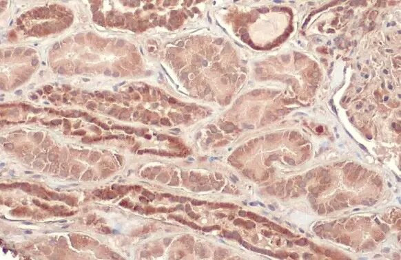 CPT1A Antibody (HL1164) - Azide and BSA Free