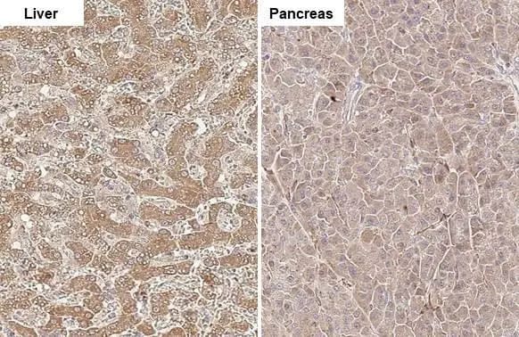 CPT1A Antibody (HL1164) - Azide and BSA Free