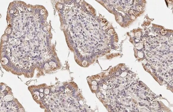 CPT1A Antibody (HL1164) - Azide and BSA Free